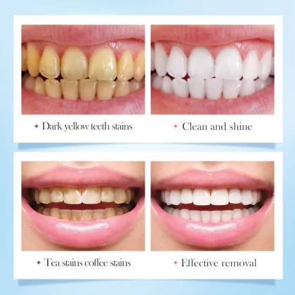 Wholesale Hot Sale Teeth Whitening Toothpaste & Oral Care Cream