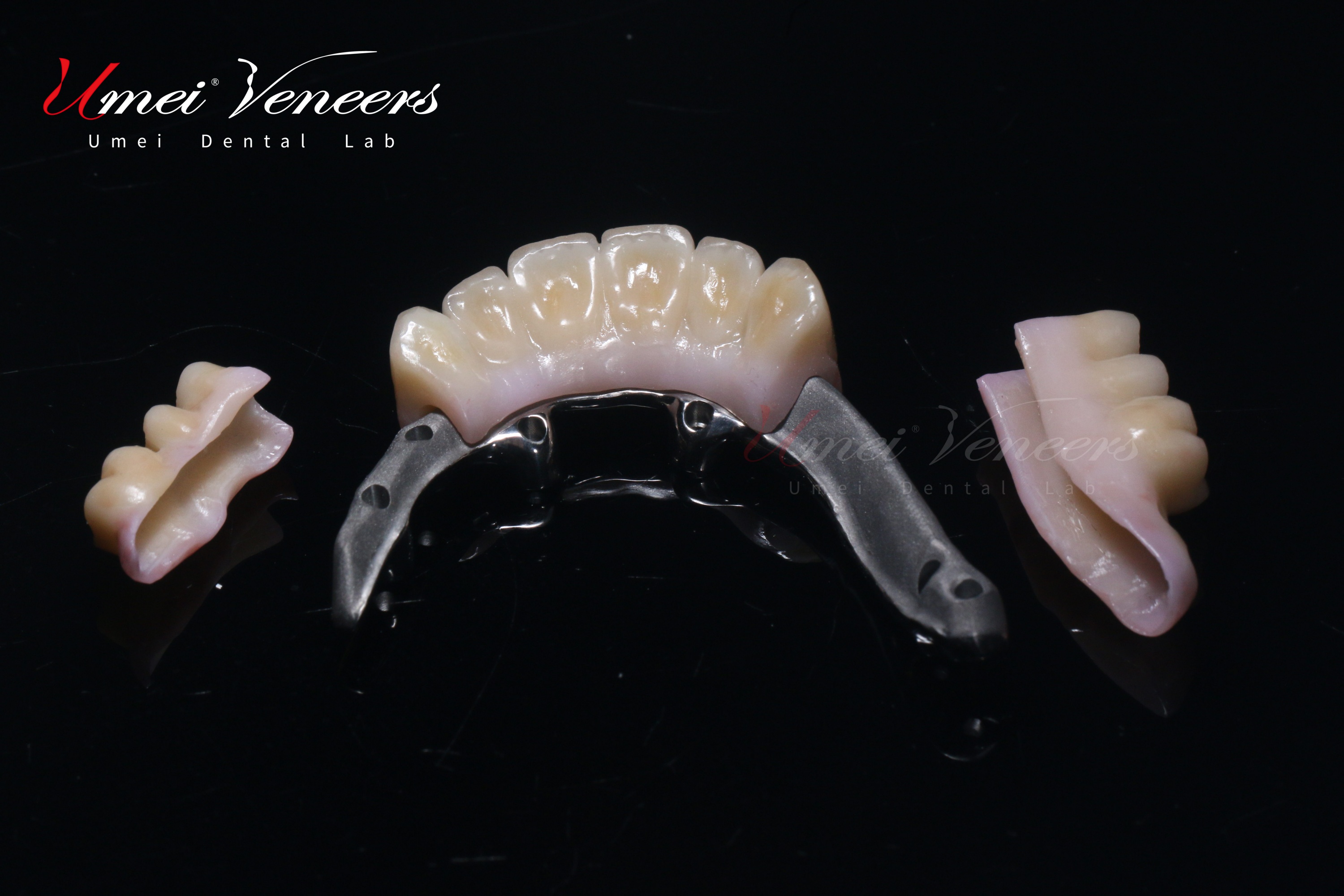 สะพานอัครริ๊ปอัครด้าน Full Arch Zirconia Malo Bridge