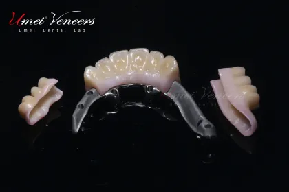 Sturdy zirconium oxide bridge frame