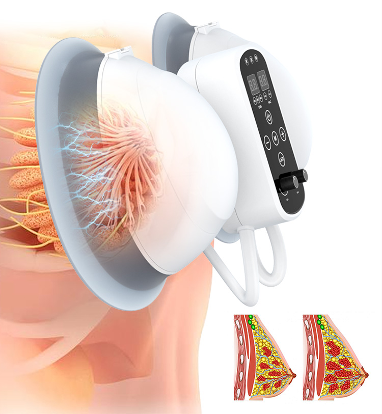 vacuum breast enlargement
