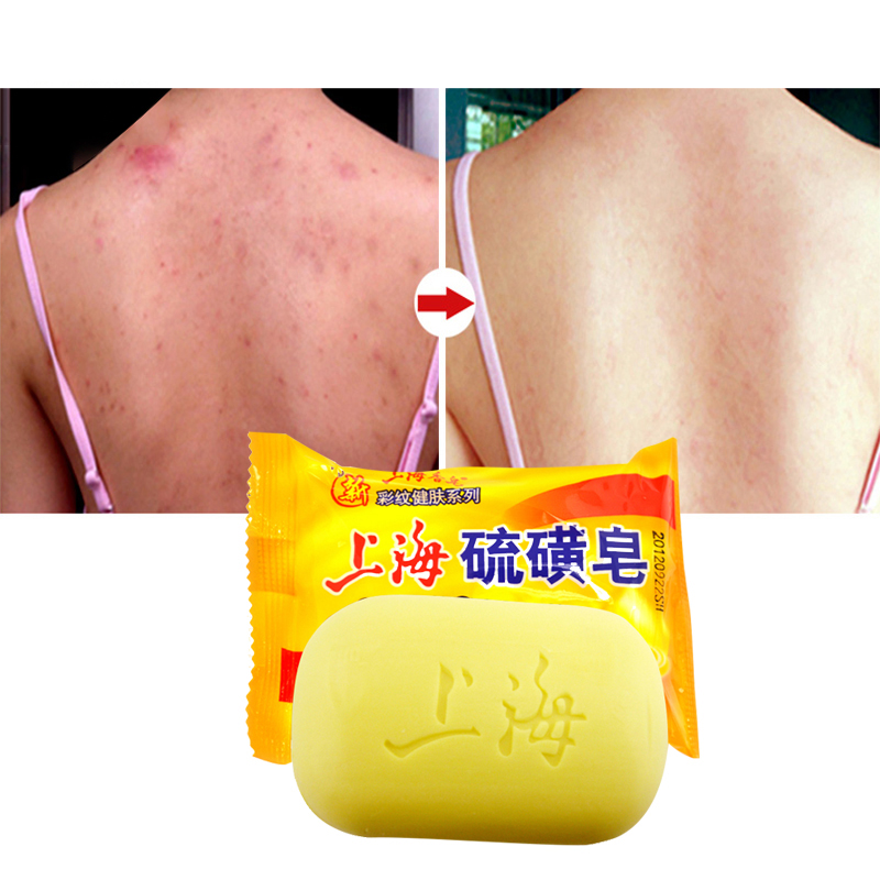 Shanghai Sulfur Soap Oil-Control Acne Treatment lackhead Remover Soap 85g Whitening Cleanser Chinese Traditional Skin Care