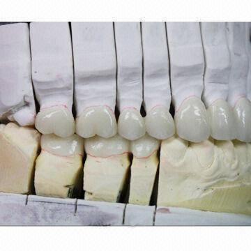 Zirconia Bridge, 5-year Guarantee Against Breakage