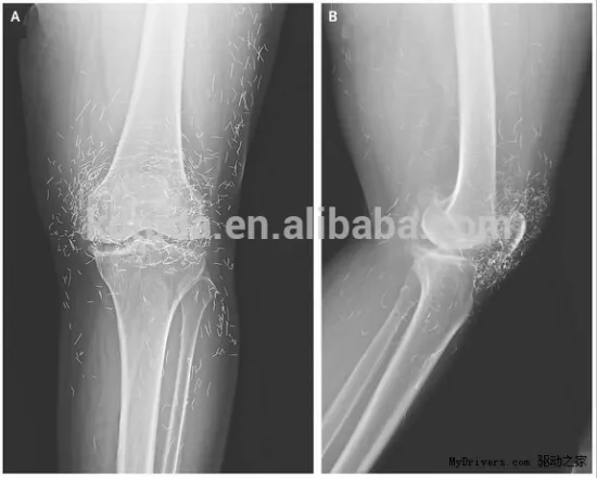 Agfa Drystar 5302 film blue based cr ct mri film factory price