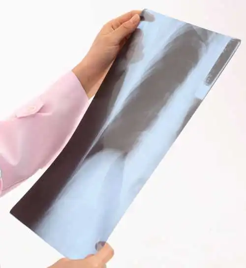 lab fujifilm medical film printer