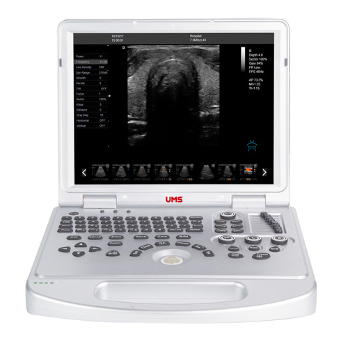 UW-L5 Laptop-Farbdoppler-Ultraschallscanner