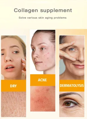 Collagen Anti-Wrinkle Essence