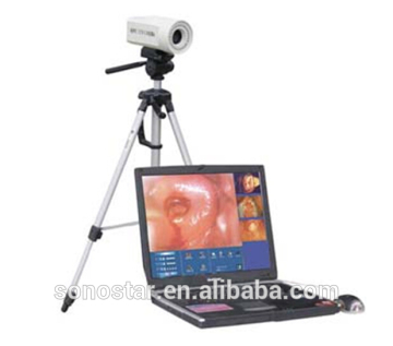 SVC-50 Colposcope(10)