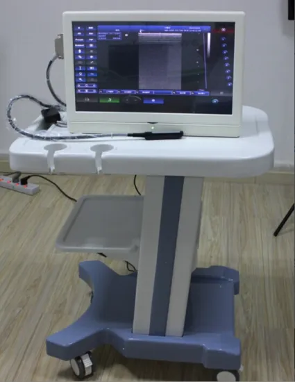 pet veterinary portable ultrasound scanner