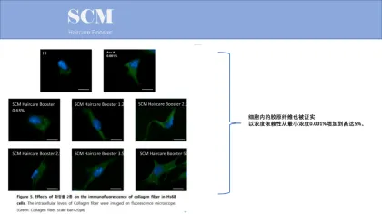 Scm Hair 5*2.5mldr Cyj Hair Filler Aapehair Growth Product Stem Cell Anti Hair Loss Treatment Human Baldness