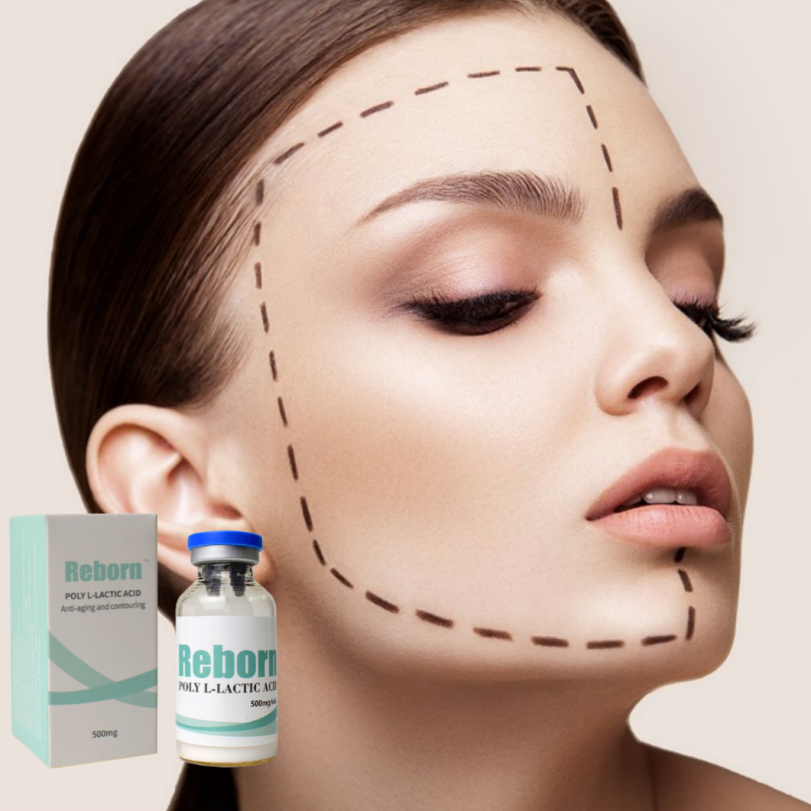 Inyección de relleno dérmico para elevación facial