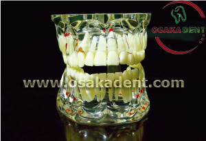 Dental Teaching Model (OSA-388)