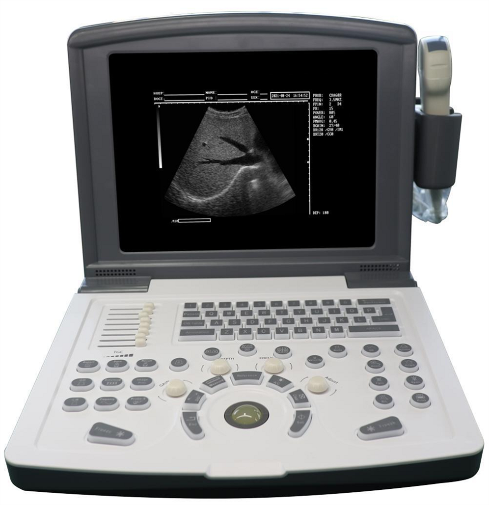 Scanner de ultrassom preto e branco portátil para obstetrícia