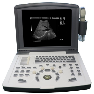 Scanner échographique noire et blanc portable pour l&#39;obstétrique