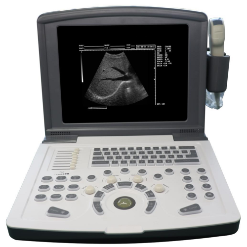 Scanner échographique noire et blanc portable pour l'obstétrique