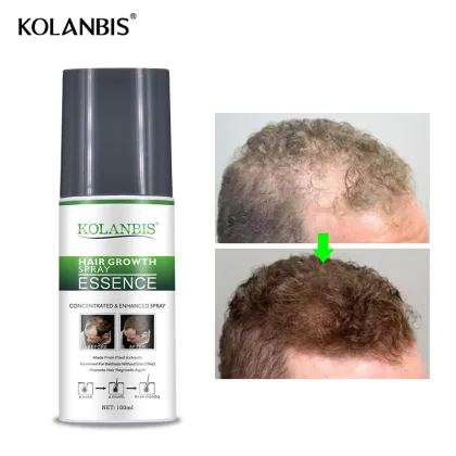 Organic Herbal Hair Regrowth Tonic for Baldness Treatment