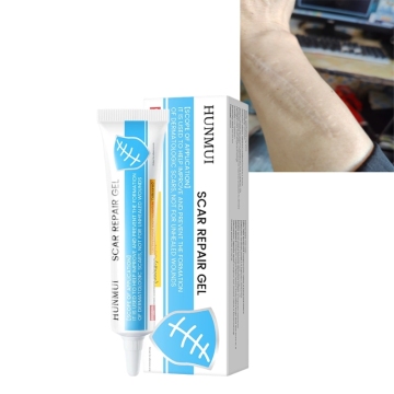 Genuine and Safe Face Scar Removal Cream Effective on Old and New Scars