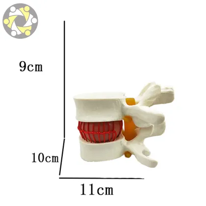 Vertebral Spine Simulator for Lumbar Disc Herniation Medical Science Model