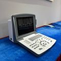 MDK-661 portable black and white ultrasound scanner