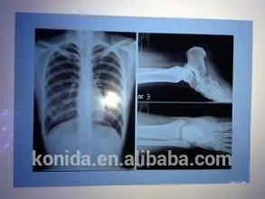 Fuji blue kodak dvd nayanthara blue film videos open sex film