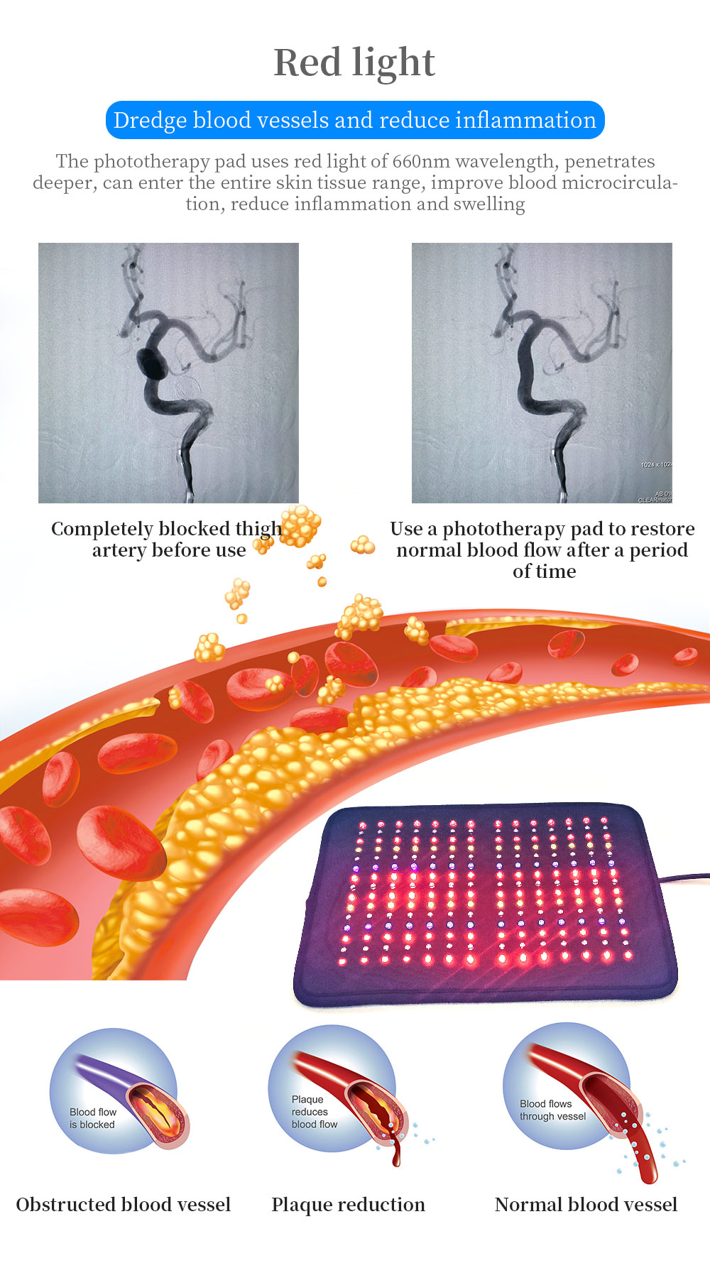 medical relief skin care PDT LED light therapy plate red infrared light physical therapy pad