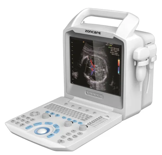 Portable Color Doppler 