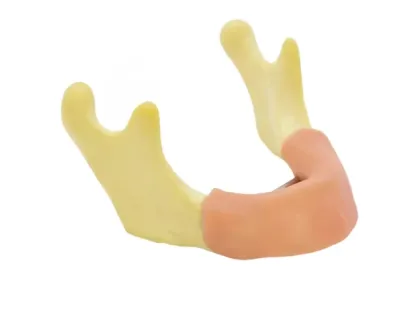 Dental Study Model Clinic Demonstration: Implant Model with Restoration and Implant Bridge