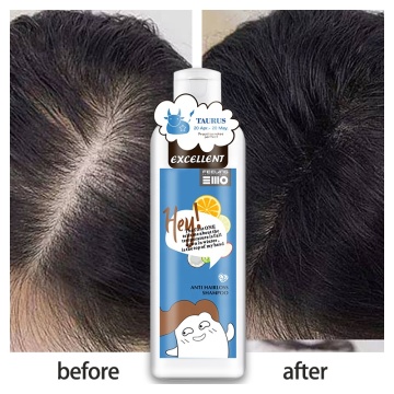 Factory Wholesale Customized Anti Hair Loss Shampoo and Conditioner