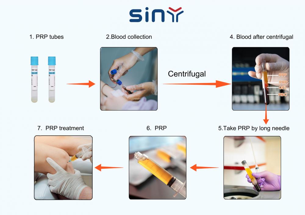 Prp For Knee Treament