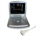 Máquina de ultrassom Doppler de cor abdominal de laptop