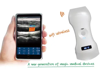 Mobile Hospital Ultrasound Scanner