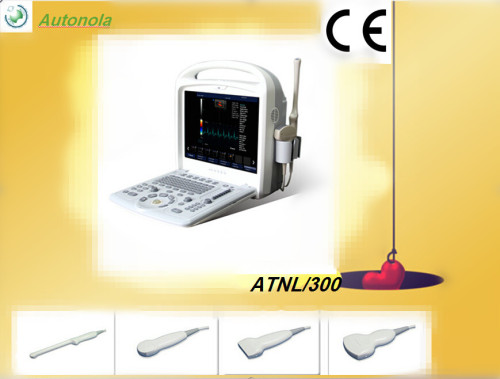 Echography Machine with Doppler (ATNL/300)