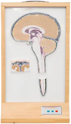 Electric model of cerebrospinal fluid circulation