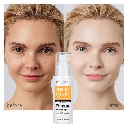 Shrinking Pore Vitamin C Fruit Acid Toner