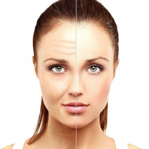 Dermal Hydrogel to Against Aging Wrinkles