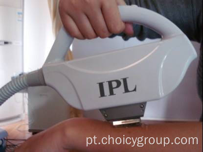 Remoção de Super Hair Choicy IPL