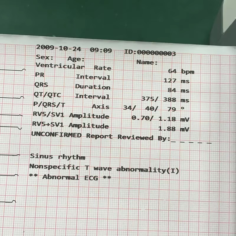 Twelve Channel EcG Machine