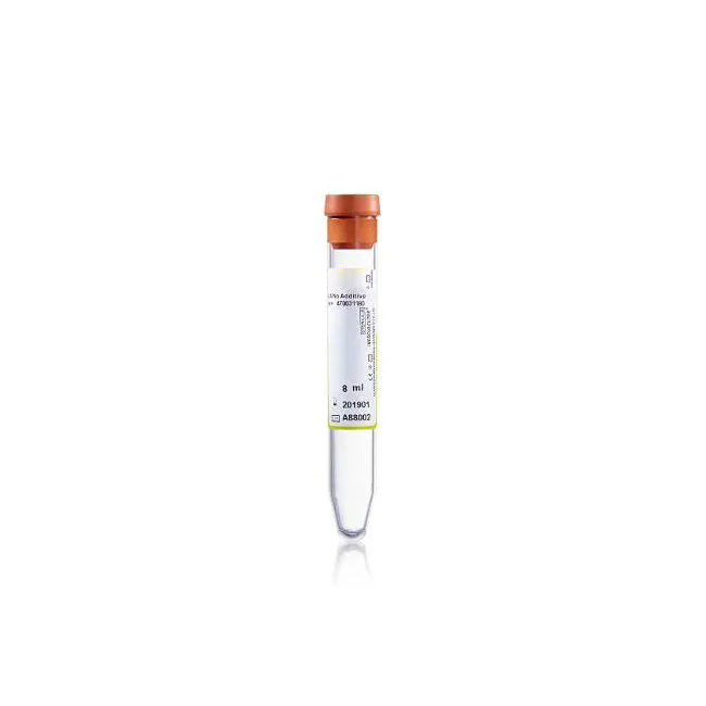 Urinalysis Tube Jpg