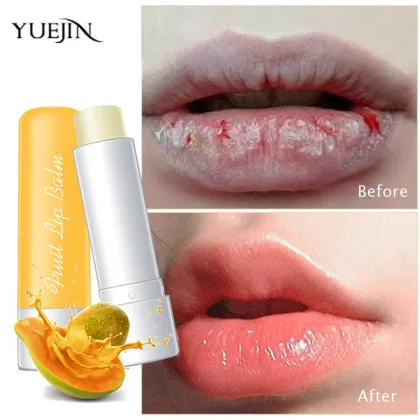 Moisturizing lightening magic coconut oil lip therapy balm