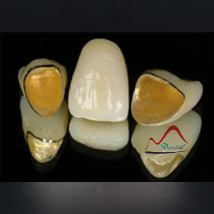 Strong dental Precious PFM