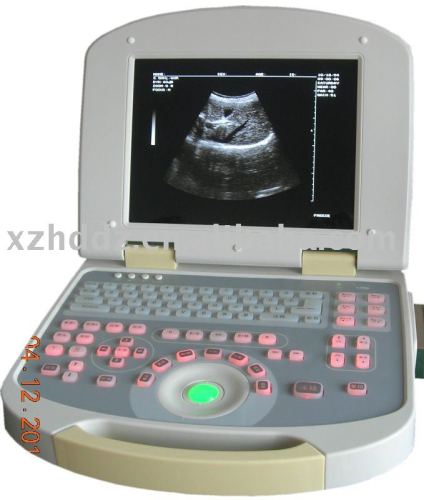 Portable Ultrasonic Diagnostic Apparatus HD-318A