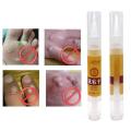 5ml Ultra Strength Skin Tag Remover 12 hours Tu kill Medical Tu kill Remover Foot Corn Skin Tag Mole & Genital Wart Remover