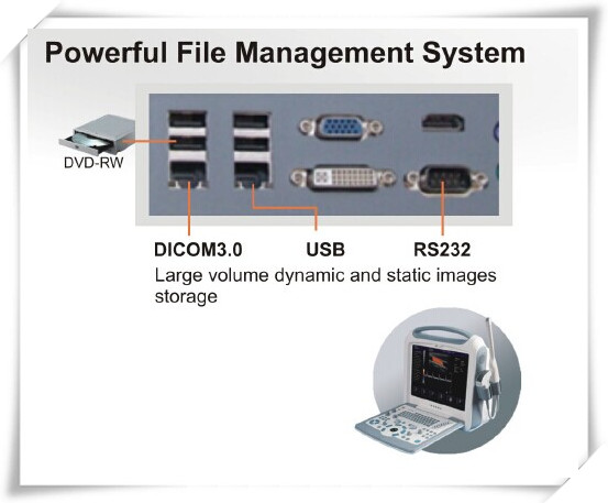 Laptop-Sized Color Doppler Diagnostic System (PRO-CDS800)