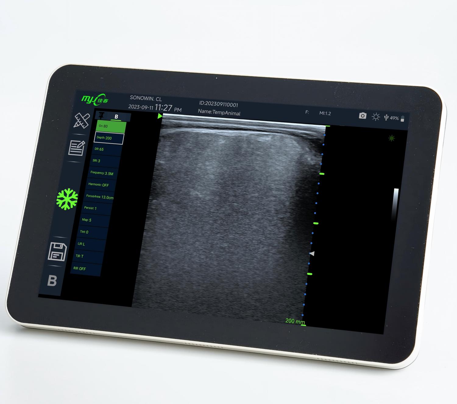 cow ultrasound machine for sale