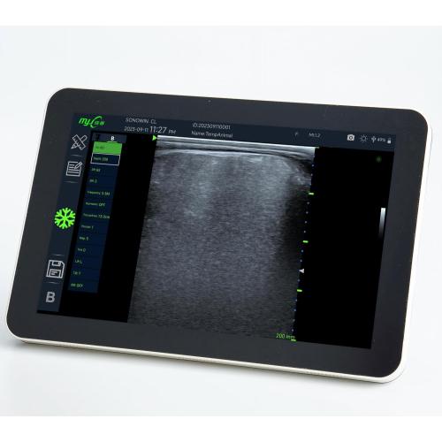 cow ultrasound scanner with L180 3.5MHz Backfat probe