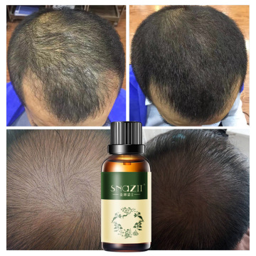Best effect hair Shampoo oil and conditioner for hair growth and hair loss prevents premature thinning hair for men and women