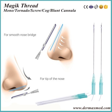 PDO Thread Lift for Nose Lifting