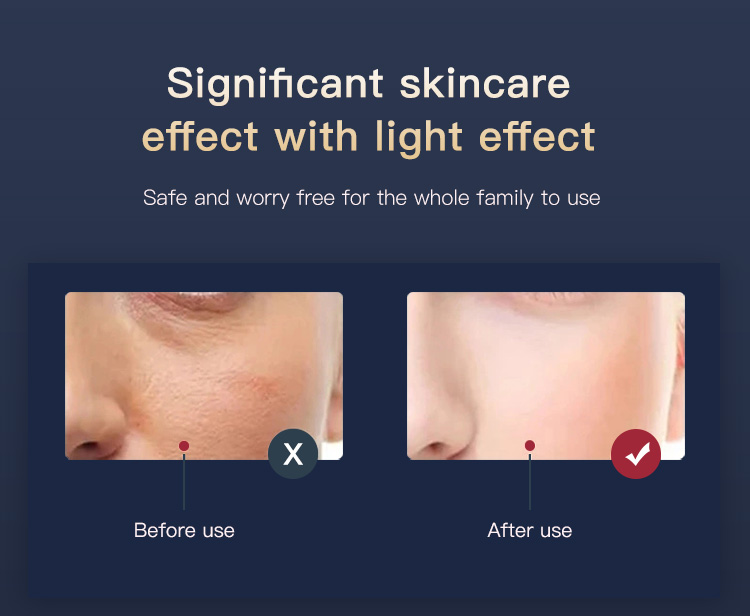 led light therapy mask