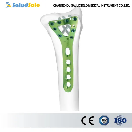 Distal Dorsal Radial Delta Locking Plate