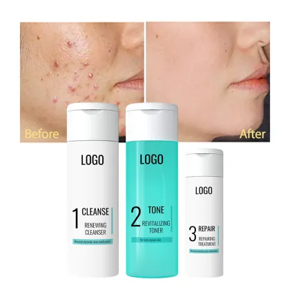 Vegan Anti-Acne Facial Care Set: Oil Control Cleanser, Moisturizer, and Toner