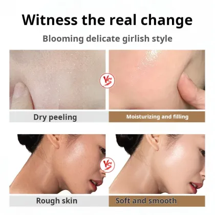 Astragalus Cream: Hydrating, Moisturizing, and Brightening Skin Discoloration Improvement Beauty Cream